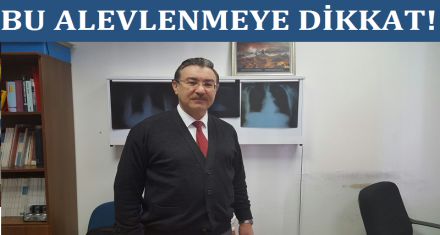 BU ALEVLENMEYE DİKKAT 