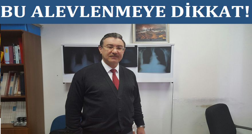 BU ALEVLENMEYE DİKKAT