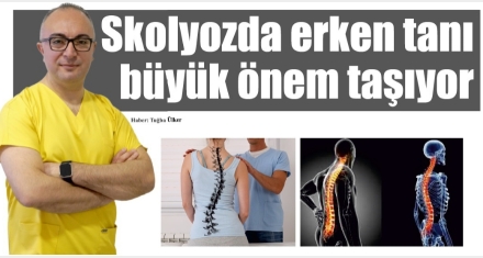 Skolyozda erken tanı büyük önem taşıyor