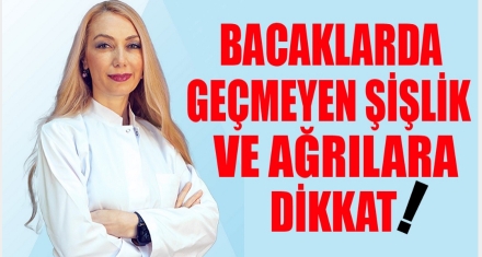 BACAKLARDA GEÇMEYEN ŞİŞLİK VE AĞRIYA DİKKAT!